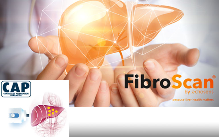 fibro02